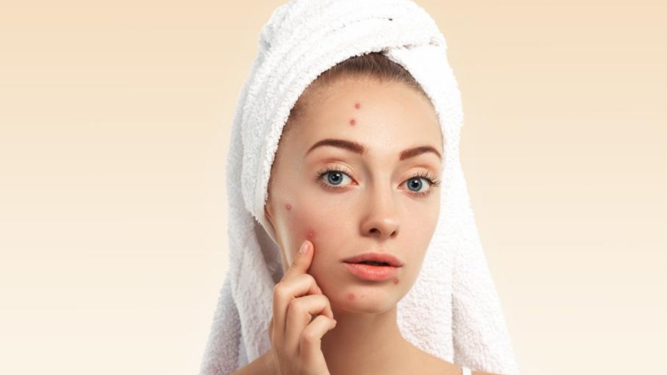 رازهای درمان آکنه و روشن‌سازی پوست با روغن میخک